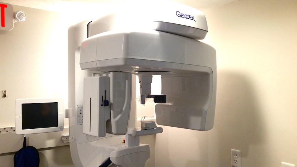 cbct1